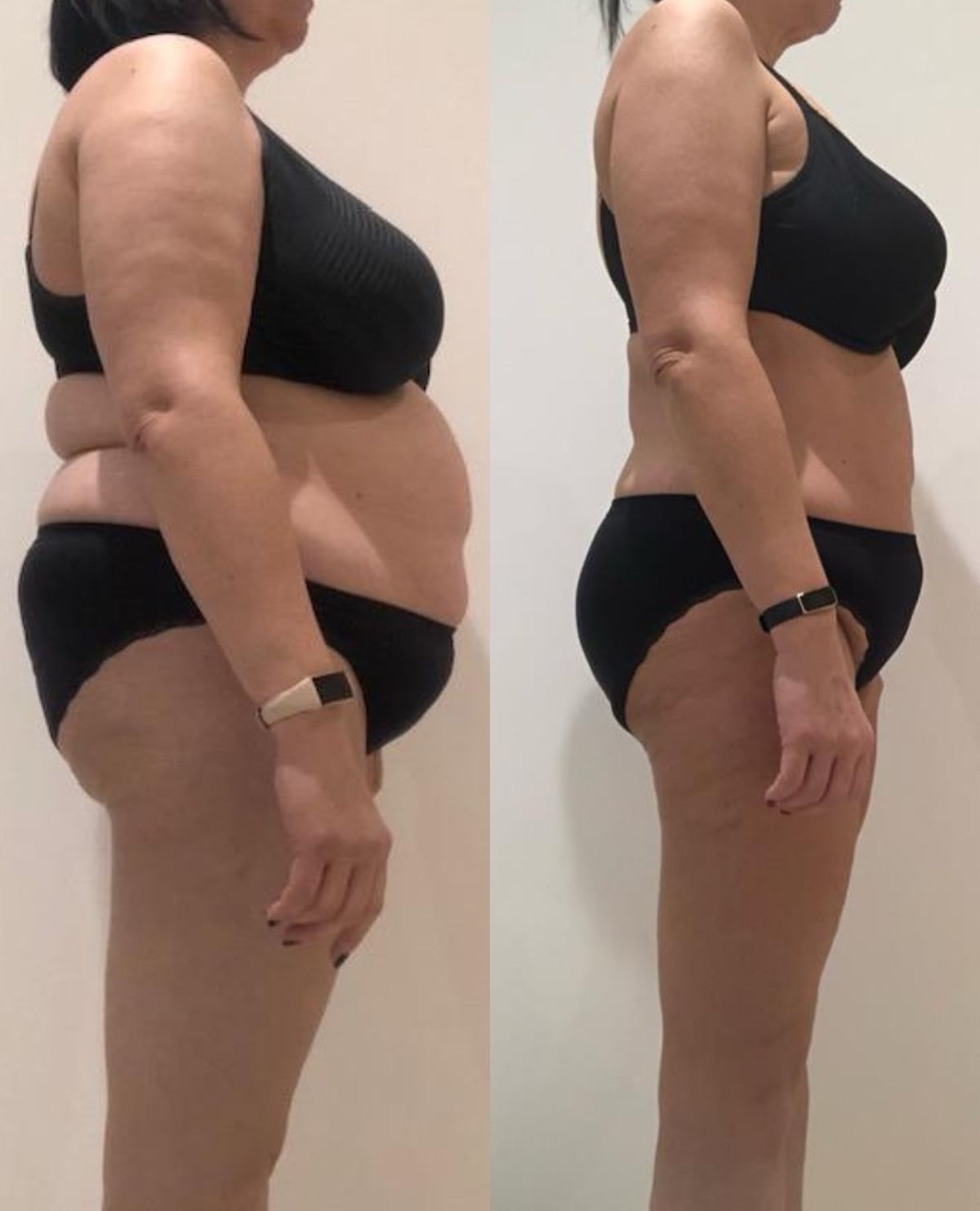 Comparativo de experiência de uso